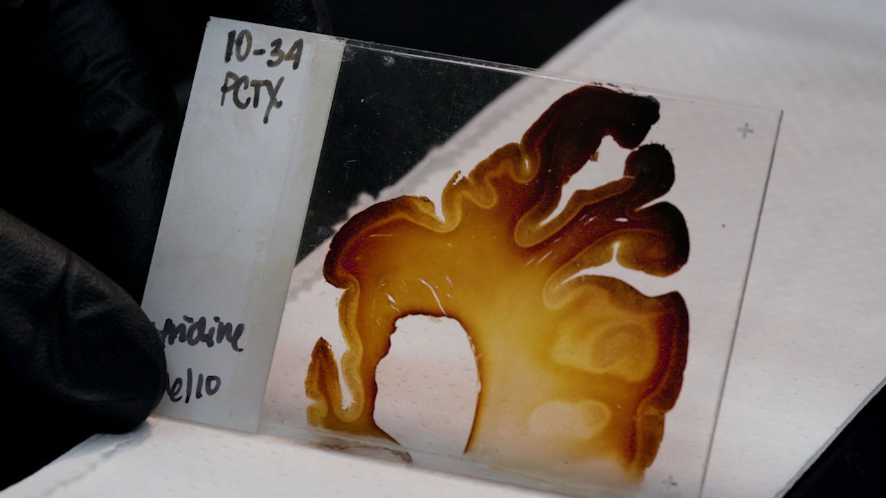 Catalyst: A viral connection - Arizona PBS