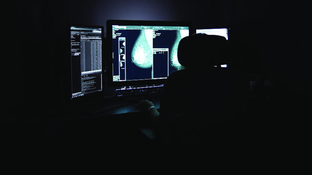 A woman looking at a mammogram
