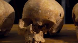 A skull