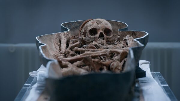 Human bones