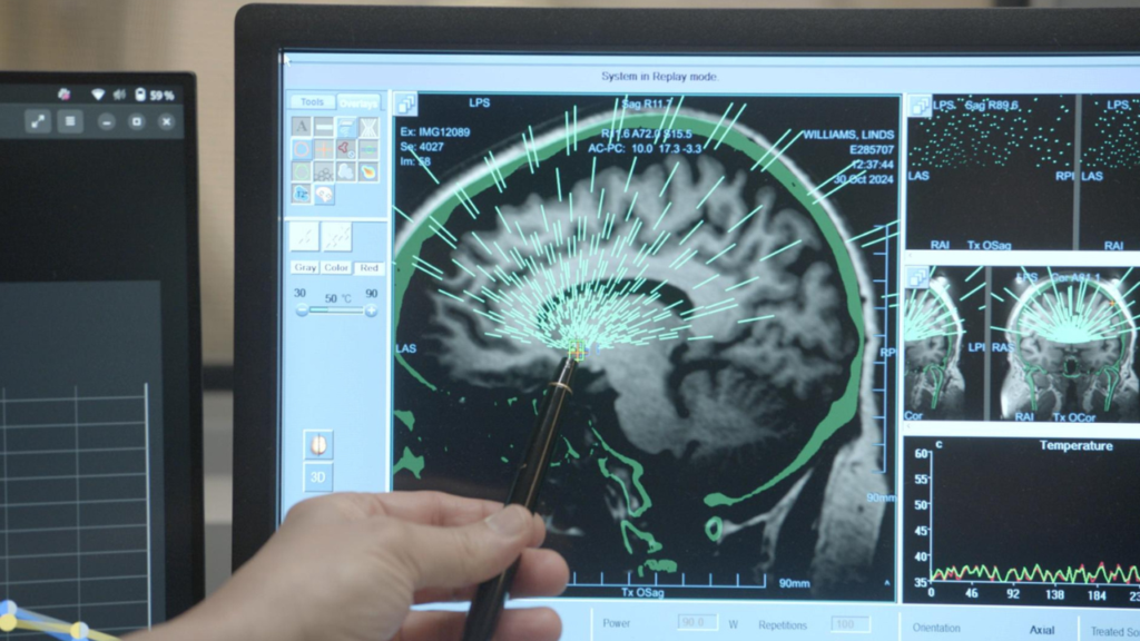 Dr. Ali Rezai describes the focused ultrasound procedure used to treat patient Lindsey Williams for binge-eating disorder.
Credit: Ezra Wolfinger © MOBIAS